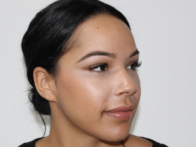 Anti-aging injections follow up